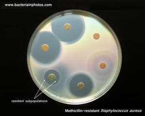 mrsa susceptibility testing